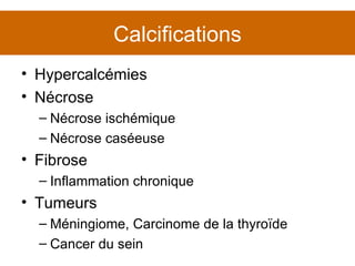 Calcifications Hypercalcémies Nécrose Nécrose ischémique Nécrose caséeuse Fibrose Inflammation chronique Tumeurs Méningiome, Carcinome de la thyroïde Cancer du sein 