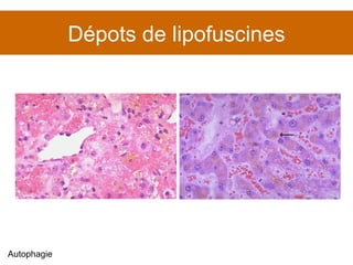 Dépots de lipofuscines Autophagie 