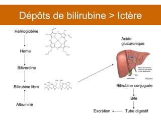 Dépôts de bilirubine > Ictère Acide glucuronique Bilirubine conjuguée Bile Tube digestif Excrétion Hémoglobine Hème Bilirubine libre Biliverdine Albumine 