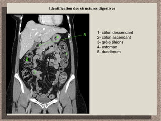 Identification des structures digestives
4
2
1
3
5
 