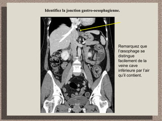 Identification des structures digestives
1
2
3
4
5
 