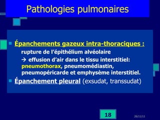 Pathologies pulmonaires Épanchements gazeux intra-thoraciques : rupture de l’épithélium alvéolaire     effusion d’air dans le tissu interstitiel:  pneumothorax , pneumomédiastin, pneumopéricarde et emphysème interstitiel. Épanchement pleural  (exsudat, transsudat) 