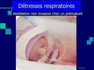 Détresses respiratoires Ventilation non invasive chez un prématuré 