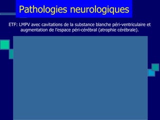 ETF: LMPV avec cavitations de la substance blanche péri-ventriculaire et augmentation de l’espace péri-cérébral (atrophie cérébrale). Pathologies neurologiques 