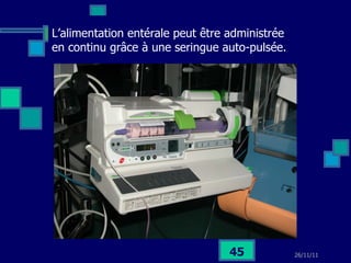 L’alimentation entérale peut être administrée en continu grâce à une seringue auto-pulsée. 