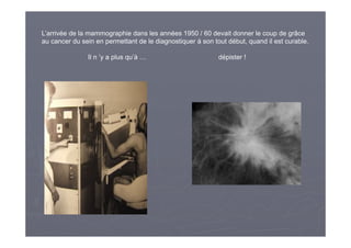 L’arrivée de la mammographie dans les années 1950 / 60 devait donner le coup de grâce
au cancer du sein en permettant de l...