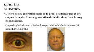 8. L’ICTÈRE
DEFINITION
• L’ictère est une coloration jaune de la peau, des muqueuses et des
conjonctives, due à une augmentation de la bilirubine dans le sang
(bilirubinémie).
• On parle généralement d’ictère lorsque la bilirubinémie dépasse 50
µmol/L (≈ 3 mg/dL).
 