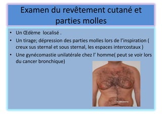 Examen du revêtement cutané et
            parties molles
• Un Œdème localisé .
• Un tirage; dépression des parties molles lors de l’inspiration (
  creux sus sternal et sous sternal, les espaces intercostaux )
• Une gynécomastie unilatérale chez l’ homme( peut se voir lors
  du cancer bronchique)
 