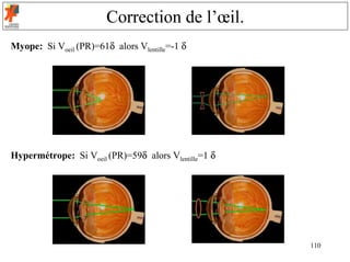 Correction de l’œil.
Myope: Si Voeil (PR)=61δ alors Vlentille=-1 δ




Hypermétrope: Si Voeil (PR)=59δ alors Vlentille=1 δ




                                                      110
 