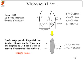 Vision sous l’eau.

                                                                                 f1 = −24.24mm
Eau n=1.33
Le dioptre sphérique             f1     f1’         f2               f2 ’        f1' = +32.24mm
d’entrée n’existe plus.                                              S’2         f 2 = −56.3mm




                                                          n2=1.42
                                                    S’1

                                          n1=1.33                    n1=1.33     f 2' = +56.3mm

                                        e=3.6mm




Focale trop grande impossible de
focaliser l’image sur la rétine, on a           f                    f’
                                                                               f = f 2 = −56.3mm
une dioptrie de 24 l’œil n’a pas un
pouvoir d’accommodation suffisant:            n=1.33                n1=1.33    f ' = f 2' = +56.3mm

            Image floue.
                                                                                          111
 