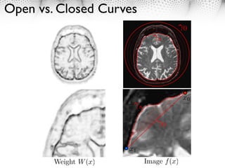 Open vs. Closed Curves
                                              0
                                    s




                                              x0
                            s

                                        0


                       x1
        Weight W (x)            Image f (x)
 