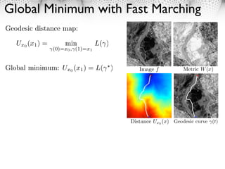 Global Minimum with Fast Marching
Geodesic distance map:

   Ux0 (x1 ) =       min           L( )
                 (0)=x0 , (1)=x1


Global minimum: Ux0 (x1 ) = L(            )      Image f           Metric W (x)




                                              Distance Ux0 (x) Geodesic curve (t)
 