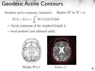 Geodesic Active Contours
 Geodesic active contours: (intrinsic)          Replace W by W + ,
                            1
      E( ) = L( ) =             W ( (t))|| (t)||dt
                        0
     (local) minimum of the weighted length L.
     local geodesic (not minimal path).




              Weight W (x)                    Curve                  4
 