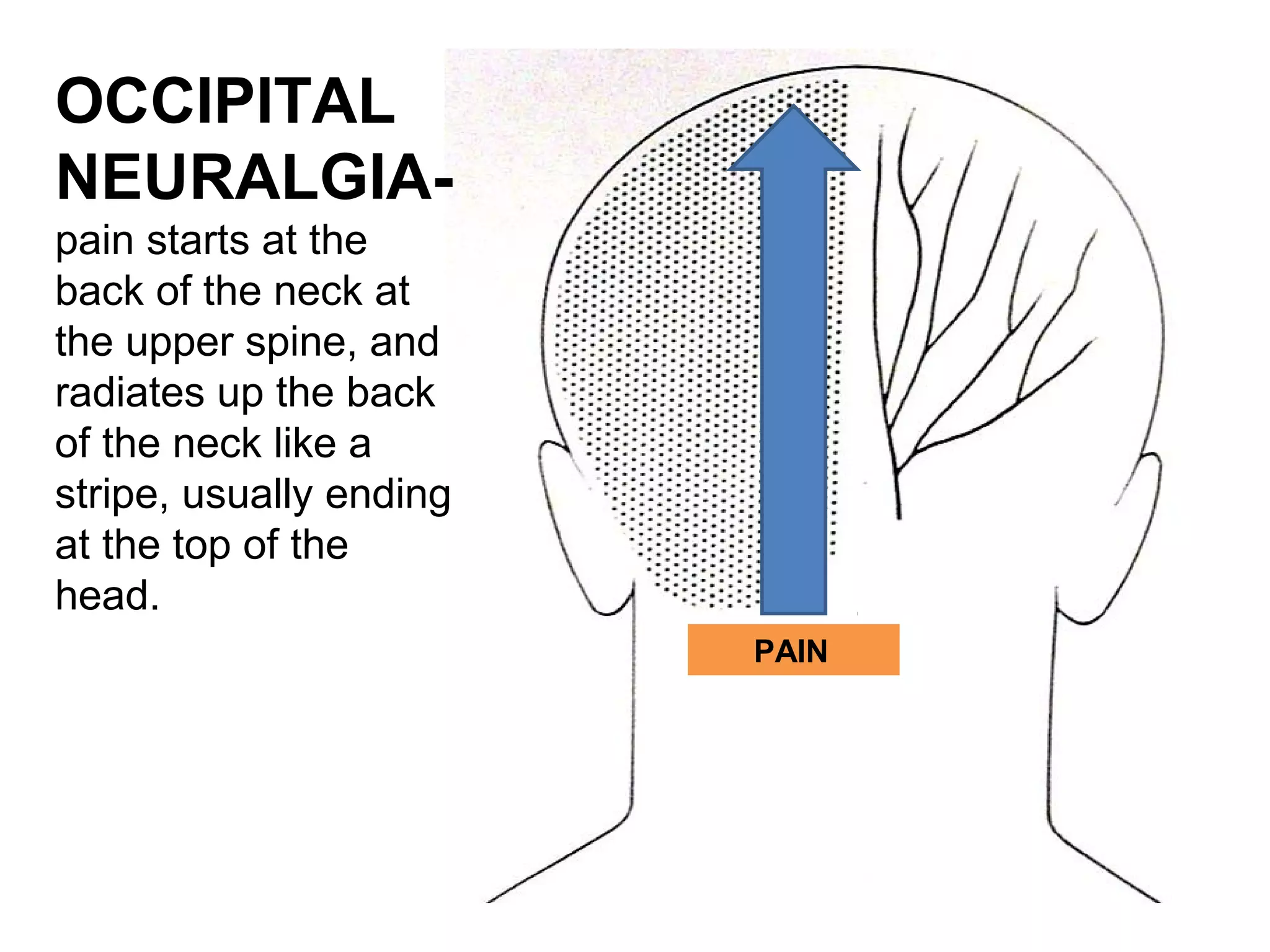 OCCIPITAL 
NEURALGIA-pain 
starts at the 
back of the neck at 
the upper spine, and 
radiates up the back 
of the neck like a 
stripe, usually ending 
at the top of the 
head. 
PAIN 
 