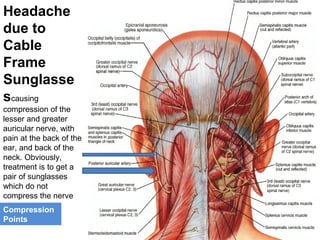 Headache 
due to 
Cable 
Frame 
Sunglasse 
scausing 
compression of the 
lesser and greater 
auricular nerve, with 
pain at the back of the 
ear, and back of the 
neck. Obviously, 
treatment is to get a 
pair of sunglasses 
which do not 
compress the nerve 
Compression 
Points 
 