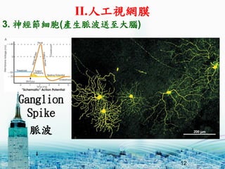 12
Ganglion
Spike
3. 񽛹(a}X)
}
II.˹ҕWĤ
 
