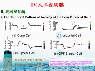 15
(a) Cone Cell (b) Horizontal Cell
(c) OFF Bipolar Cell(d) ON Bipolar Cell
?The Temporal Pattern of Activity at the Four Kinds of Cells
Reference:
Roska B, Nemeth E, Orzo L, Werblin FS (2000) Three Levels
of Lateral Inhibition: A Space-Time Study of the Retina of the
Tiger Salamander. J. Neurosci., 20(5):1941-1951
* 3: At the center of the stimulus
* 4: At the edge of the stimulus
5. ҕWĤܘ
IV.˹ҕWĤ
15
 