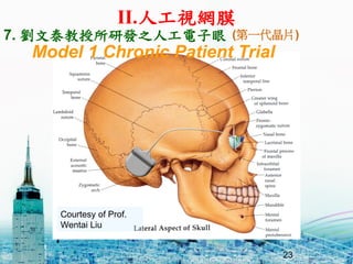 23
Model 1 Chronic Patient Trial
Courtesy of Prof.
Wentai Liu
7. ̩аl֮˹ (һƬ)
II.˹ҕWĤ
 