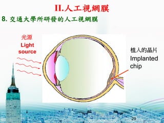 29
Light
source
Implanted
chip
8. ͨWаl˹ҕWĤ
ֲľƬ
Դ
II.˹ҕWĤ
 