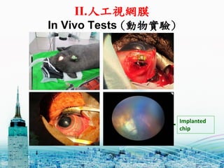II.˹ҕWĤ
In Vivo Tests ()
32
Implanted
chip
 