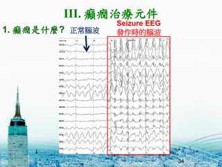 34
Seizure EEG
lrX
III. dBίԪ
1. dBʲN? X
 