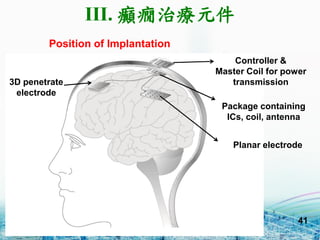 41
Position of Implantation
Controller &
Master Coil for power
transmission
Package containing
ICs, coil, antenna
Planar electrode
3D penetrate
electrode
III. dBίԪ
 
