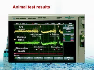 48
Seizure
occurrence
Seizure
occurrence
Stimulation on Stimulation on
AFE
output
Wireless
signal
Stimulation
Enable
Animal test results
 