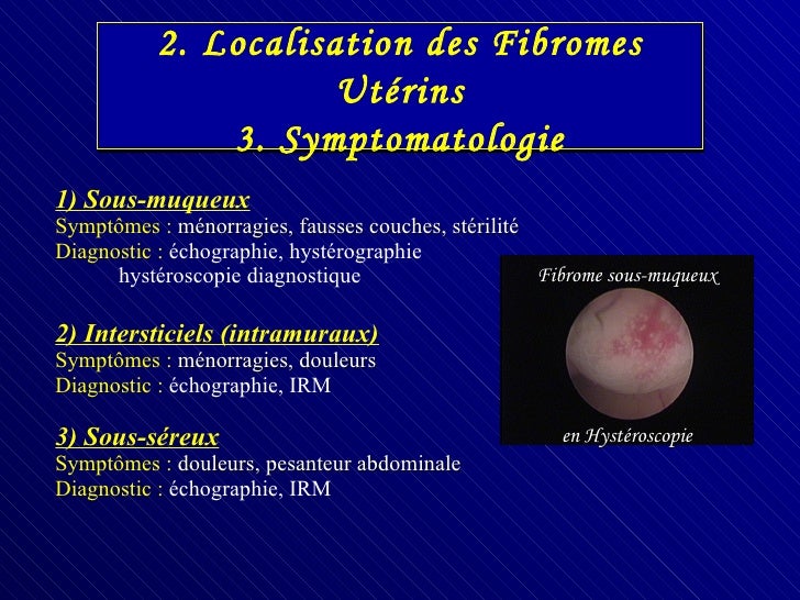 Cours GynéCo Ifsi NîMes