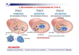 Phase I Phase II Phase III
FORMATION
de complexes Immuns
DÉPOSITION
de complexes Immuns
INFLAMATION
provoquée par complexes
Immuns
ype
s
us),
arteriti
ococc
nephr
ction
kness
II. MECHANISMES de l’HYPERSENSIBILITE TYPE III
LB Plasmocyte
Complexes Ac-
Ag
Endothélium
Complexes Ac-Ag
Complément
Vascularite
Enzymes Lysosomales des PNN
ody
merular
s
ype
s
us),
arteriti
ococc
nephr
ction
kness
Agrégation des plaquettes Libération de facteurs de coagulation Formation de Microthrombi Nécrose
Chimiotactisme
INFLAMATION
 
