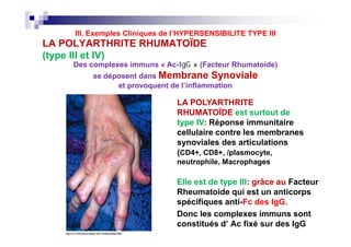 LA POLYARTHRITE RHUMATOÏDE
(type III et IV)
Des complexes immuns « Ac-IgGIgG »» (Facteur Rhumatoide)
se déposent dans Membrane Synoviale
et provoquent de l’inflammation
LA POLYARTHRITE
RHUMATOÏDE est surtout de
type IV: Réponse immunitaire
cellulaire contre les membranes
synoviales des articulations
(CD4+, CD8+, /plasmocyte,
neutrophile, Macrophages
III. Exemples Cliniques de l’HYPERSENSIBILITE TYPE III
Elle est de type III: grâce au Facteur
Rheumatoide qui est un anticorps
spécifiques anti-Fc des IgG.
Donc les complexes immuns sont
constitués d’ Ac fixé sur des IgG
LA POLYARTHRITE
RHUMATOÏDE est surtout de
type IV: Réponse immunitaire
cellulaire contre les membranes
synoviales des articulations
(CD4+, CD8+, /plasmocyte,
neutrophile, Macrophages
 