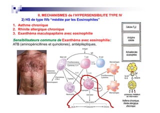 (3) HS de type IVc “médiée par les CTL”
1. Dermatite de contacte
2. Rejet de transplant
3. Allergie aux médicaments:
Exan...