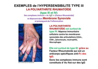 Cours hypersensibilité ii et iii medecine 2017