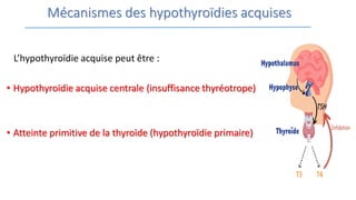 Mécanismes des hypothyroïdies acquises
L’hypothyroïdie acquise peut être :
• Hypothyroïdie acquise centrale (insuffisance thyréotrope)
• Atteinte primitive de la thyroïde (hypothyroïdie primaire)
 