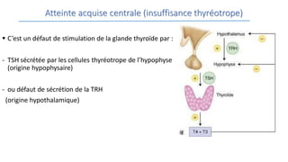 Atteinte acquise centrale (insuffisance thyréotrope)
 C’est un défaut de stimulation de la glande thyroïde par :
- TSH sécrétée par les cellules thyréotrope de l’hypophyse
(origine hypophysaire)
- ou défaut de sécrétion de la TRH
(origine hypothalamique)
 
