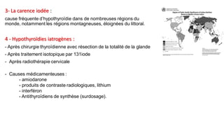 3- La carence iodée :
cause fréquente d’hypothyroïdie dans de nombreuses régions du
monde, notamment les régions montagneuses, éloignées du littoral.
4 - Hypothyroïdies iatrogènes :
- Après chirurgie thyroïdienne avec résection de la totalité de la glande
- Après traitement isotopique par 131iode
- Après radiothérapie cervicale
- Causes médicamenteuses :
- amiodarone
- produits de contraste radiologiques, lithium
- interféron
- Antithyroïdiens de synthèse (surdosage).
 