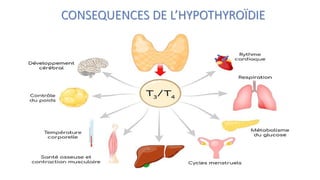 CONSEQUENCES DE L’HYPOTHYROÏDIE
 
