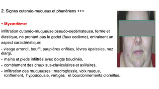 2. Signes cutanéo-muqueux et phanériens +++
 Myxœdème:
infiltration cutanéo-muqueuse pseudo-oedémateuse, ferme et
élastique, ne prenant pas le godet (faux oedème), entrainant un
aspect caractéristique:
- visage arrondi, bouffi, paupières enflées, lèvres épaissies, nez
élargi,
- mains et pieds infiltrés avec doigts boudinés,
- comblement des creux sus-claviculaires et axillaires,
- infiltration des muqueuses : macroglossie, voix rauque,
ronflement, hypoacousie, vertiges et bourdonnements d’oreilles.
 