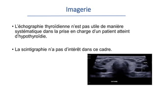 Imagerie
• L’échographie thyroïdienne n’est pas utile de manière
systématique dans la prise en charge d’un patient atteint
d’hypothyroïdie.
• La scintigraphie n’a pas d’intérêt dans ce cadre.
 