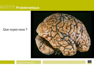 Département Informatique
Problématique
Que voyez-vous ?
 