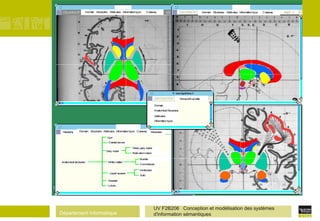 Département Informatique
UV F2B206 Conception et modélisation des systèmes
d'information sémantiques
Domain Structures Attributes Informationtype Cutaway Domain Structures Attributes Informationtype Cutaway
Domain Structures Attributes Informationtype CutawayHierarchy
Anatomicalstructures White matter
Liquid spaces
Vessels
Lobes
Sulci
Gyri
Cranialnerves
Grey nuclei
Deep grey nulcei
Brainstemnulcei
Ventricules
Bundle
Commissure
Domain
Anatomical Structures
Attributes
Informationtype
Structures
Viewpoint update
 