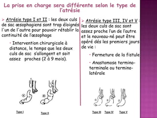 La prise en charge sera différente selon le type de
l’atrésie
 Atrésie type I et II : les deux culs

 Atrésie type III, IV et V :

de sac œsophagiens sont trop éloignés les deux culs de sac sont
l'un de l'autre pour pouvoir rétablir la assez proche l’un de l’autre
continuité de l’œsophage
et le nouveau-né peut être
opéré dés les premiers jours
• Intervention chirurgicale à
de vie :
distance, le temps que les deux
culs de sac s’allongent et soit
assez proches (2 à 9 mois).

Type I

Type II

• Fermeture de la fistule
• Anastomose terminoterminale ou terminolatérale

Type III

Type IV

Type V

 