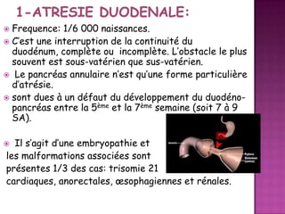 Frequence: 1/6 000 naissances.
 C’est une interruption de la continuité du
duodénum, complète ou incomplète. L’obstacle le plus
souvent est sous-vatérien que sus-vatérien.
 Le pancréas annulaire n’est qu’une forme particulière
d’atrésie.
 sont dues à un défaut du développement du duodénopancréas entre la 5ème et la 7ème semaine (soit 7 à 9
SA).


Il s’agit d’une embryopathie et
les malformations associées sont
présentes 1/3 des cas: trisomie 21
cardiaques, anorectales, œsophagiennes et rénales.



 