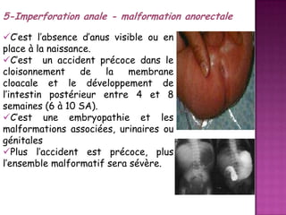 5-Imperforation anale - malformation anorectale
C’est l’absence d’anus visible ou en
place à la naissance.
C’est un accident précoce dans le
cloisonnement
de
la
membrane
cloacale et le développement de
l’intestin postérieur entre 4 et 8
semaines (6 à 10 SA).
C’est une embryopathie et les
malformations associées, urinaires ou
génitales
Plus l’accident est précoce, plus
l’ensemble malformatif sera sévère.

 