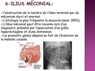 l’obstruction de la lumière de l’iléon terminal par du
méconium durci et anormal.
L’étiologie la plus fréquente la mucoviscidose (98%).
L’iléus méconial peut être reconnu lors d’un
diagnostic prénatal par l’association d’un grêle
hyperéchogène et d’une distension.
Le pronostic global dépend en fait de l’évolution de
la maladie causale.

 