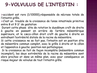 accident est rare (1/10000),résponsable de nécrose totale de
l’intestin grêle.
C’est un trouble de la croissance de l’anse intestinale primitive
entre 8 et 9 S° de gestation
Durant cette phase dite de rotation le duodénum croît de droite
à gauche en passant en arrière de l’artère mésentérique
supérieure, et le cæco-côlon droit croît de gauche à droite en
entraînant l’extrémité distale de la racine du mésentère.
Si cette croissance ne se fait pas, l’intestin est en position dite
de mésentère commun complet, avec le grêle à droite et le côlon
et l’appendice à gauche :position non pathologique.
Si la croissance se fait de façon incomplète (mésentère commun
incomplet), les deux extrémités de la racine du mésentère sont
alors proches et dans un même plan, avec pour conséquence un
risque majeur de volvulus de tout l’intestin grêle.

 