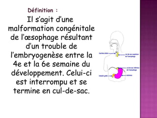 Définition :

Il s’agit d’une
malformation congénitale
de l’œsophage résultant
d’un trouble de
l’embryogenèse entre la
4e et la 6e semaine du
développement. Celui-ci
est interrompu et se
termine en cul-de-sac.

 