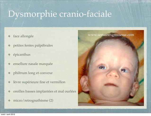 cours-alcool-et-grossesse-ifas-ppt