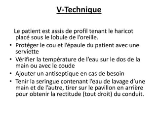 V-Technique
Le patient est assis de profil tenant le haricot
placé sous le lobule de l’oreille.
• Protéger le cou et l’épaule du patient avec une
serviette
• Vérifier la température de l’eau sur le dos de la
main ou avec le coude
• Ajouter un antiseptique en cas de besoin
• Tenir la seringue contenant l’eau de lavage d’une
main et de l’autre, tirer sur le pavillon en arrière
pour obtenir la rectitude (tout droit) du conduit.
 