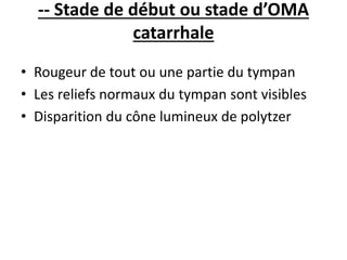 -- Stade de début ou stade d’OMA
catarrhale
• Rougeur de tout ou une partie du tympan
• Les reliefs normaux du tympan sont visibles
• Disparition du cône lumineux de polytzer
 