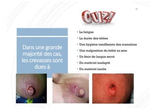 Dans une grande
majorité des cas,
les crevasses sont
dues à
§ La fatigue
§ La durée des tétées
§ Une hygiène insuffisante des mamelons
§ Une malposition du bébé au sein
§ Un frein de langue serré
§ Du matériel inadapté
§ Du matériel inutile
26
 